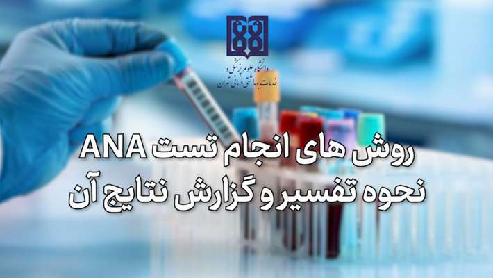 وبینار روش های تست ANA، نحوه تفسیر و گزارش نتایج