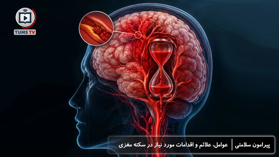 سکته مغزی، عوامل، علائم و اقدامات مورد نیاز